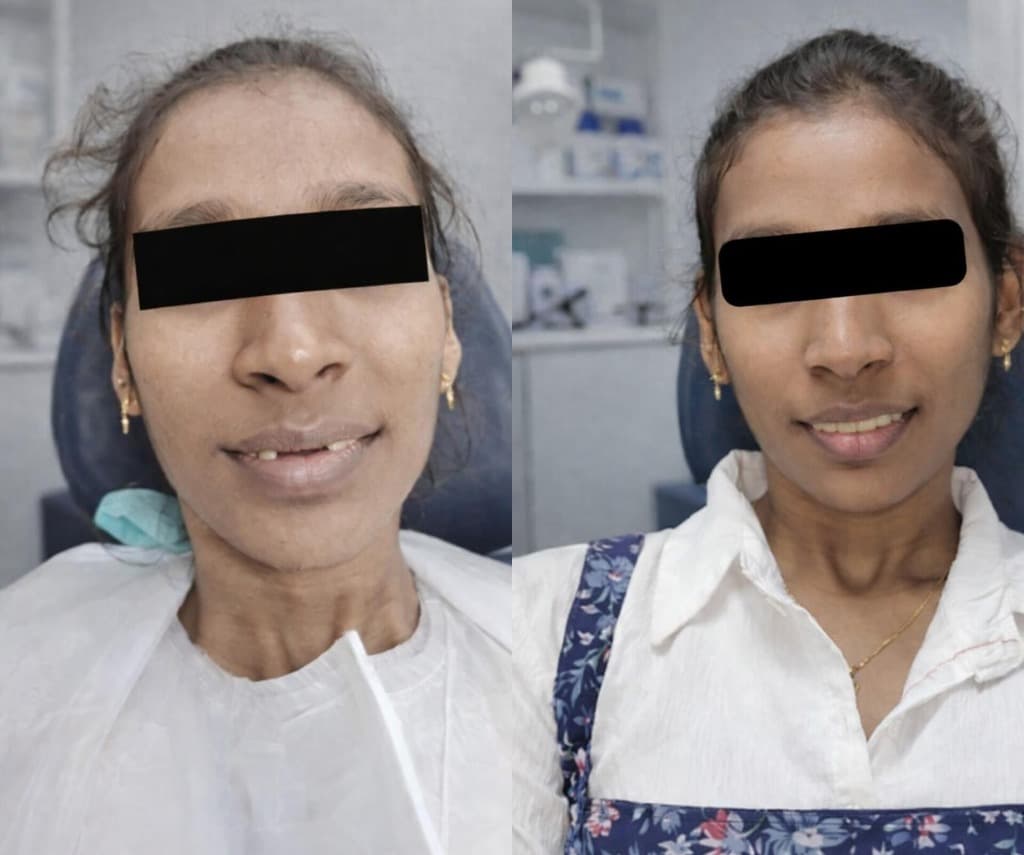 Patient Before and After Transformation
