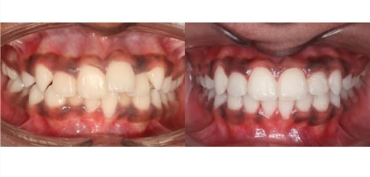 Patient Before and After Transformation