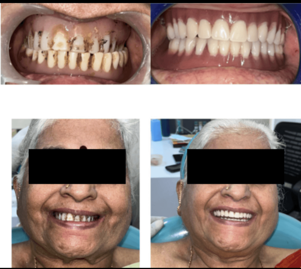 Patient Before and After Transformation
